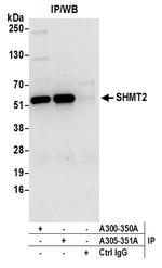 SHMT2 Antibody in Immunoprecipitation (IP)