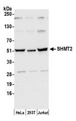 SHMT2 Antibody in Western Blot (WB)