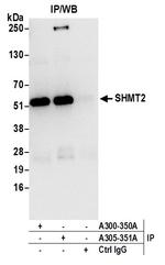 SHMT2 Antibody in Immunoprecipitation (IP)