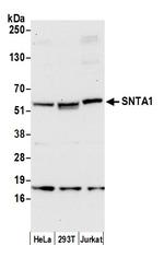 SNTA1 Antibody in Western Blot (WB)