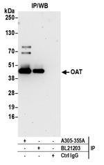 OAT Antibody in Immunoprecipitation (IP)