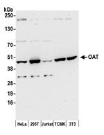 OAT Antibody in Western Blot (WB)