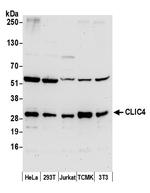 CLIC4 Antibody in Western Blot (WB)