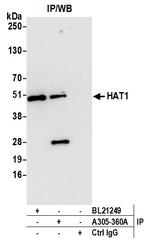 HAT1/KAT1 Antibody in Immunoprecipitation (IP)