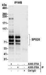 SPG20 Antibody in Immunoprecipitation (IP)