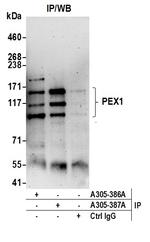 PEX1 Antibody in Immunoprecipitation (IP)