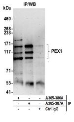 PEX1 Antibody in Immunoprecipitation (IP)