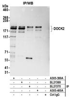 DOCK2 Antibody in Immunoprecipitation (IP)