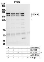 DOCK2 Antibody in Immunoprecipitation (IP)