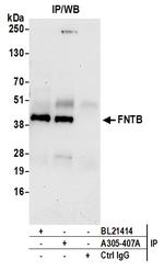 FNTB Antibody in Immunoprecipitation (IP)