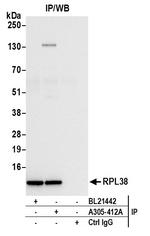 RPL38/Ribosomal Protein L38 Antibody in Immunoprecipitation (IP)