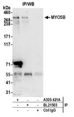 MYO5B Antibody in Immunoprecipitation (IP)