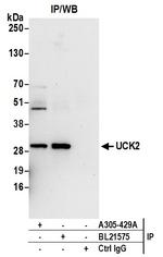 UCK2 Antibody in Immunoprecipitation (IP)