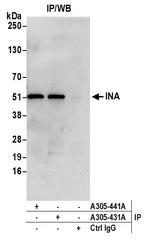 INA Antibody in Immunoprecipitation (IP)