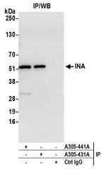 INA Antibody in Immunoprecipitation (IP)