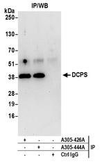 DCPS Antibody in Immunoprecipitation (IP)