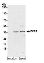 DCPS Antibody in Western Blot (WB)