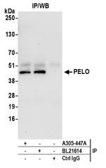 PELO Antibody in Immunoprecipitation (IP)