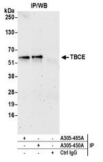 TBCE Antibody in Immunoprecipitation (IP)