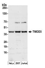 TMOD3 Antibody in Western Blot (WB)