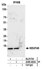 NDUFA5 Antibody in Immunoprecipitation (IP)