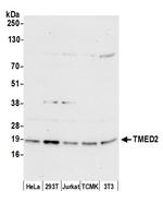 TMED2 Antibody in Western Blot (WB)