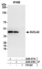 SUCLA2 Antibody in Immunoprecipitation (IP)