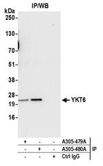 YKT6 Antibody in Immunoprecipitation (IP)