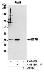 ETFB Antibody in Immunoprecipitation (IP)