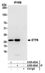 ETFB Antibody in Immunoprecipitation (IP)