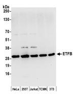 ETFB Antibody in Western Blot (WB)