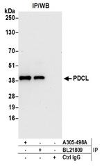 PDCL Antibody in Immunoprecipitation (IP)