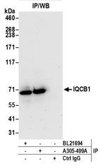 IQCB1 Antibody in Immunoprecipitation (IP)