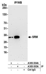 SRM Antibody in Immunoprecipitation (IP)