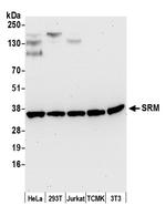 SRM Antibody in Western Blot (WB)