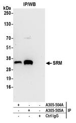 SRM Antibody in Immunoprecipitation (IP)