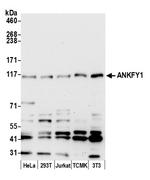 ANKFY1 Antibody in Western Blot (WB)