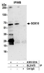 SOX10 Antibody in Immunoprecipitation (IP)