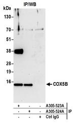 COX5B Antibody in Immunoprecipitation (IP)