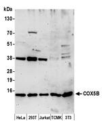 COX5B Antibody in Western Blot (WB)