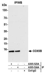 COX5B Antibody in Immunoprecipitation (IP)