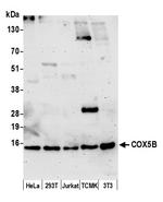 COX5B Antibody in Western Blot (WB)