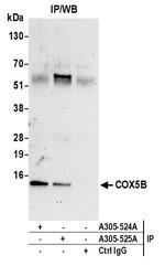 COX5B Antibody in Immunoprecipitation (IP)