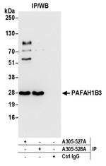 PAFAH1B3 Antibody in Immunoprecipitation (IP)