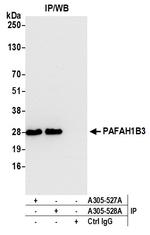 PAFAH1B3 Antibody in Immunoprecipitation (IP)