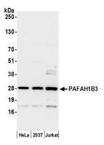 PAFAH1B3 Antibody in Western Blot (WB)