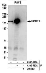 UGGT1 Antibody in Immunoprecipitation (IP)