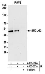 SUCLG2 Antibody in Immunoprecipitation (IP)