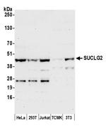 SUCLG2 Antibody in Western Blot (WB)