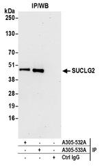 SUCLG2 Antibody in Immunoprecipitation (IP)